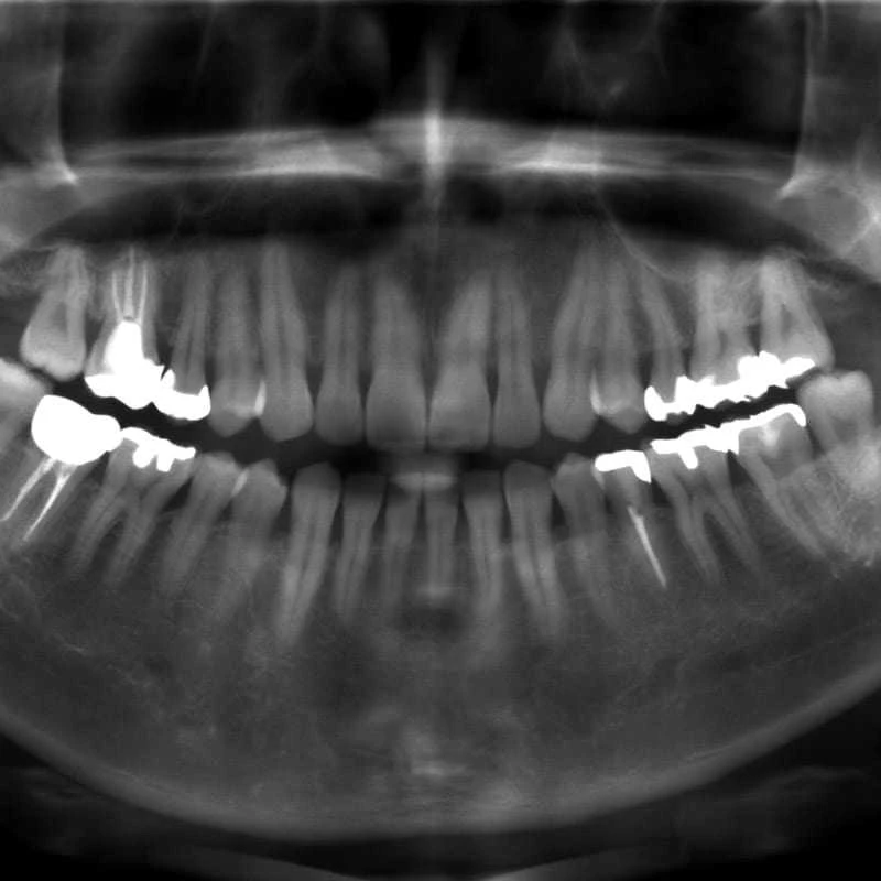 kỹ thuật số(DDAE)