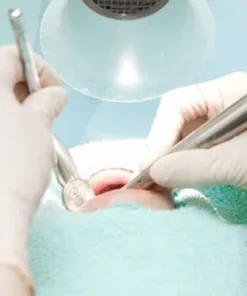 May-hut-vo-khuan-Free-Arm-Forte