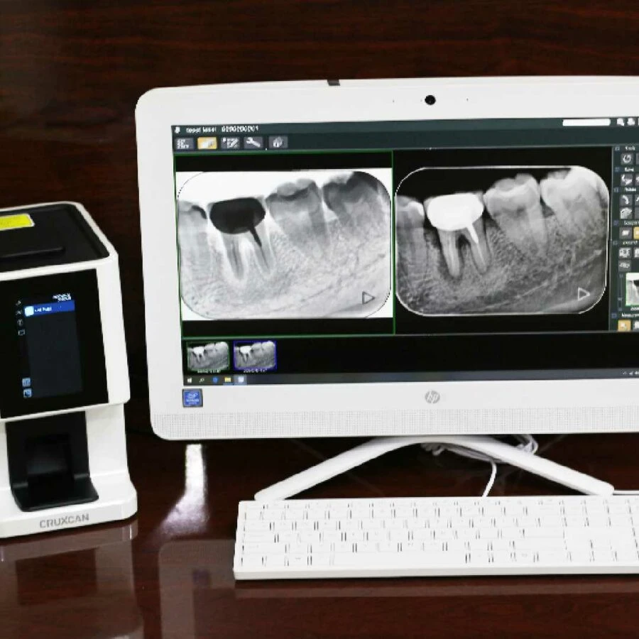 cho hình ảnh chính xác nhanh chóng