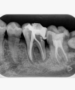 x quang ghế ngồi Morita