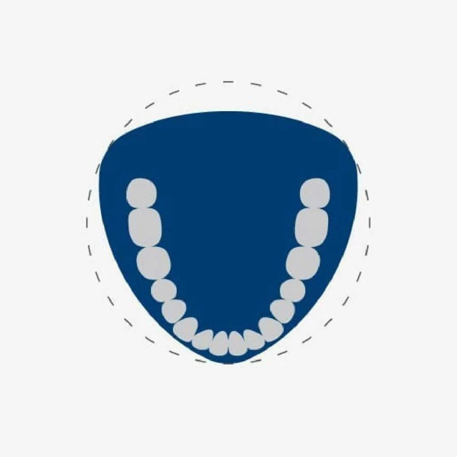 Máy X-quang nha khoa 3D Veraviewepocs R100 mô phỏng