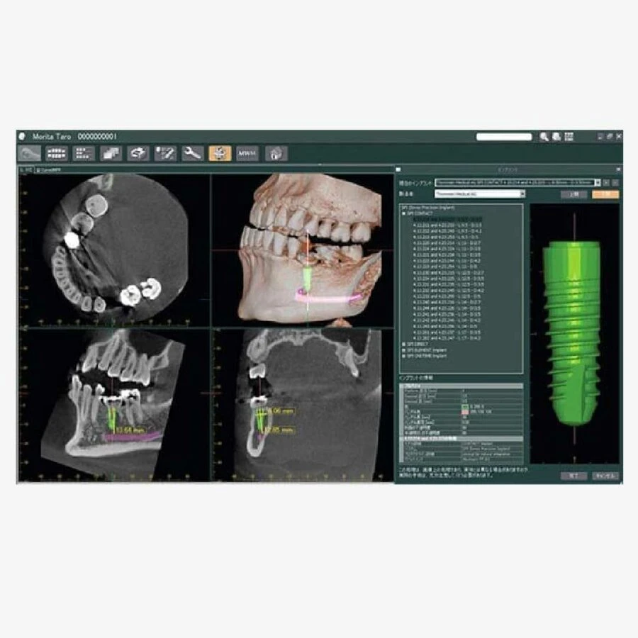 xquang-veraviewepocs-3D-R100-F40
