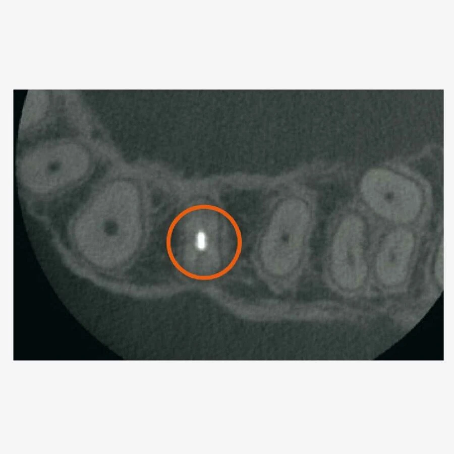 chi tiết nhỏ nhất